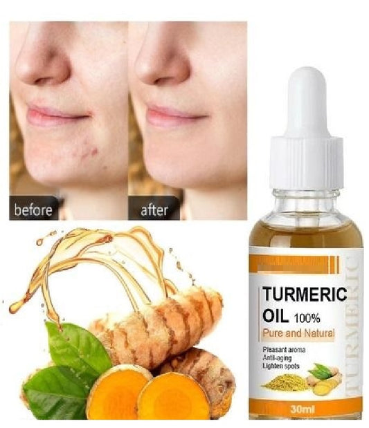 Turmeric Oil 30 ML (Pack of 2)