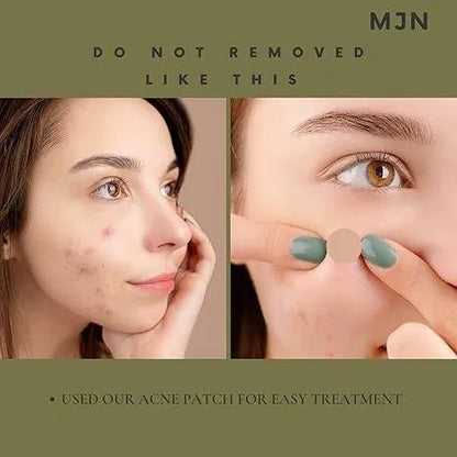 Acne Clearing Pimple Patches