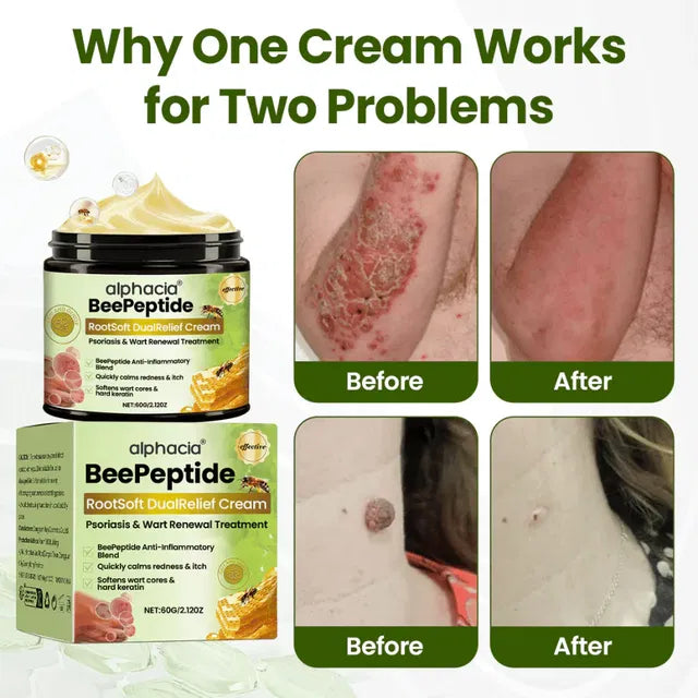 BeePeptide RootSoft DualRelief Cream ( Pack of 2 )