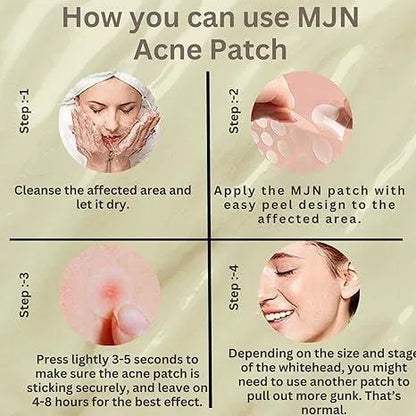 Acne Clearing Pimple Patches
